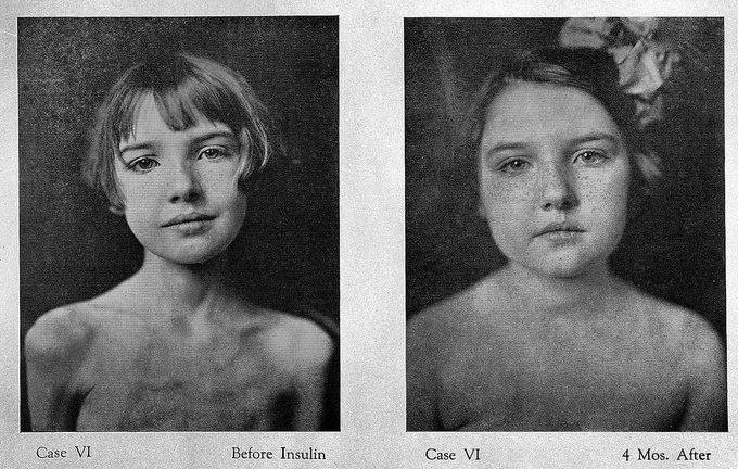 Case VI Before and After